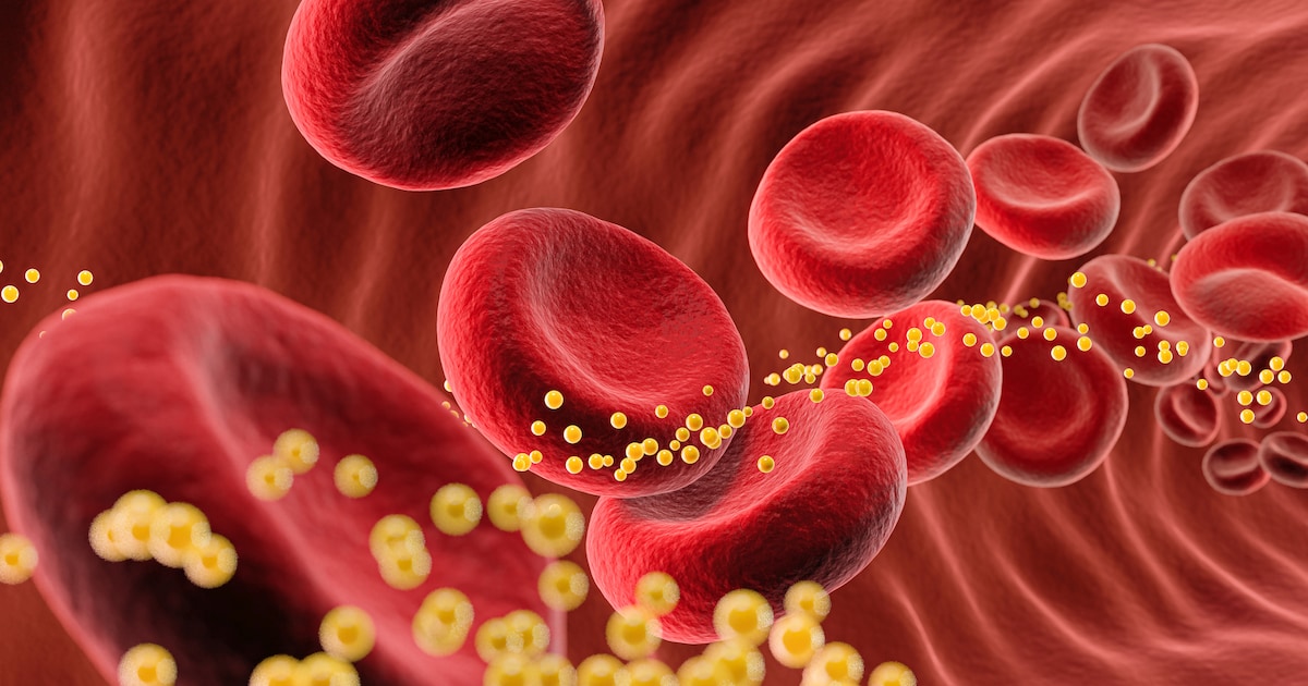 Lipoprotein(a): Every adult should check this heart value once in their life