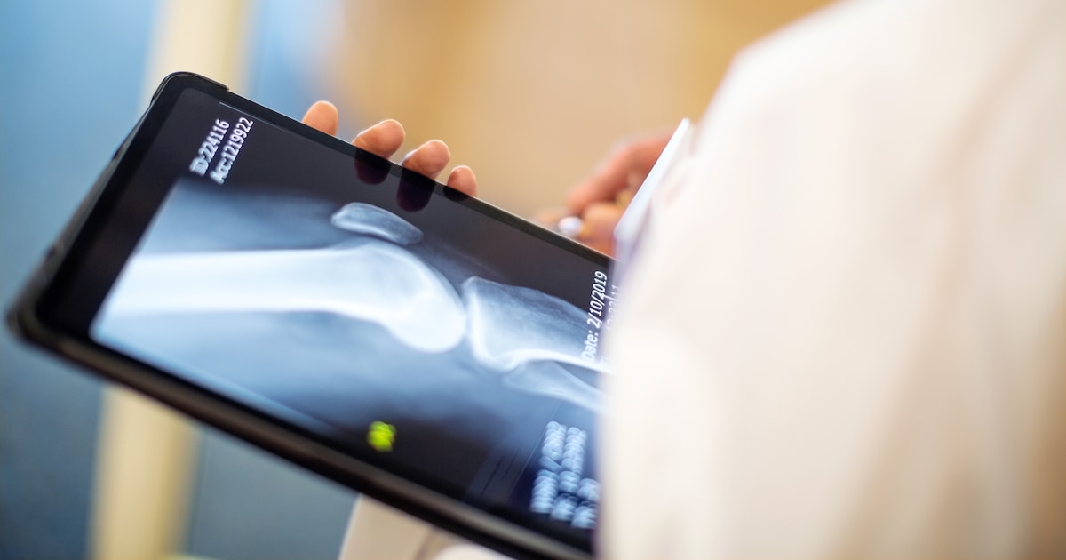 3-minute test shows how high your risk of osteoporosis is